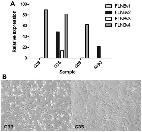 expression level of filamin B (FLNB) transcript variants in giant cell ... 