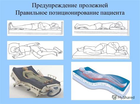 Пролежни профилактика пролежней презентация