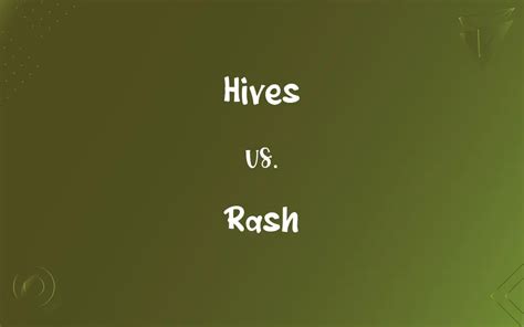 Hives vs. Rash: What’s the Difference?