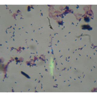 Gram stain from the positive blood culture. Numerous gram-positive rods ...