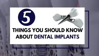 PPT Important Facts About Dental Implants You Should Know PowerPoint