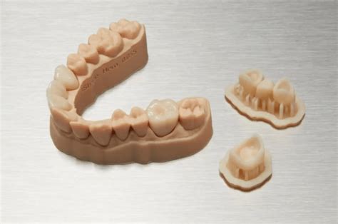 Prótesis dentales impresas en 3D Para clínicas privadas Smileep