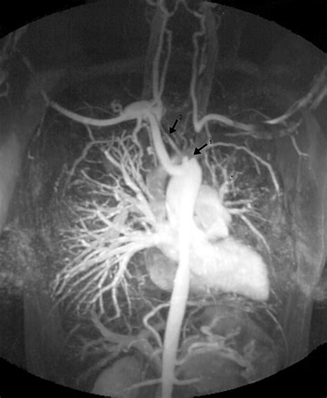Case Number 27: Jaw claudication in Takayasu’s disease | Annals of the