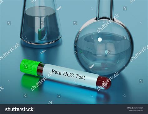 752 Hcg Hormon Images Stock Photos And Vectors Shutterstock