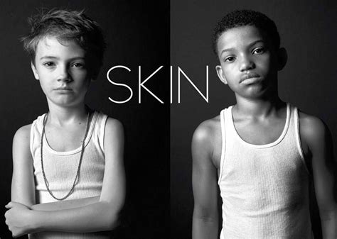 Skin Short Film Review