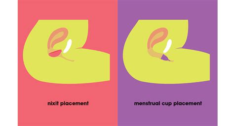 Menstrual Disc: Your A to Z Beginner Guide – nixit