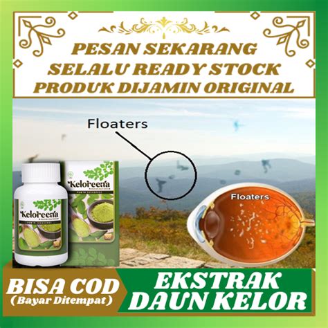 Obat Penghilang Floaters Ablasio Retina Mata Floater Ablasi Retina