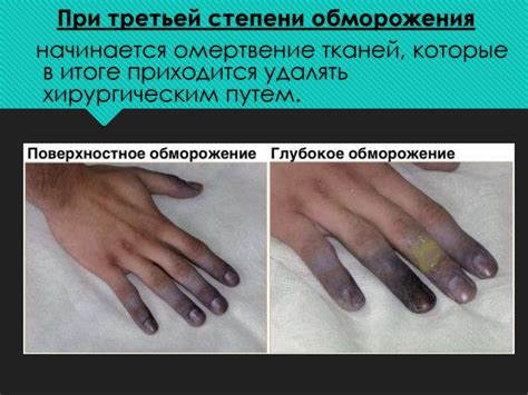 Травмы в зимней период времени - презентация онлайн