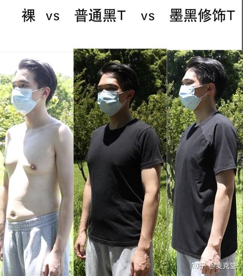 雌化胸人士摸索出的：男士胸部肥大专属“改善雌化脂肪胸、塑形减脂锻炼套餐”——“1 1随心配” 知乎