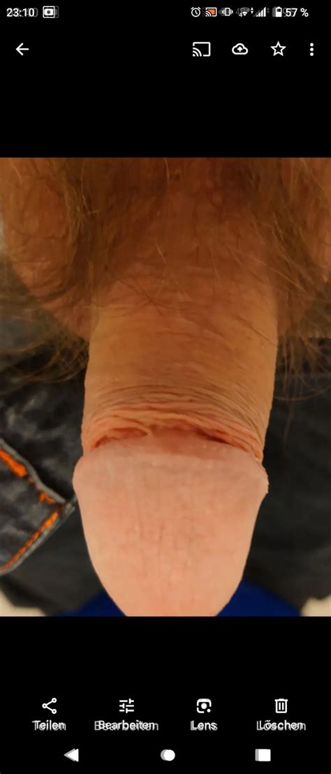 My Stiff Penis Nude Pics Xhamster