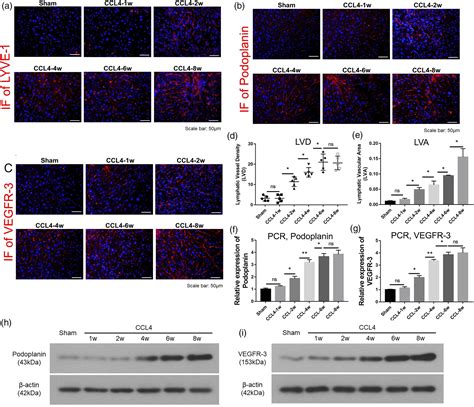 MiR 155 5p SOCS1 JAK1 STAT1 Participates In Hepatic Lymphangiogenesis