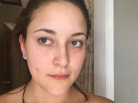 Baylee Adami: Learning To Live With The Leak's Scars