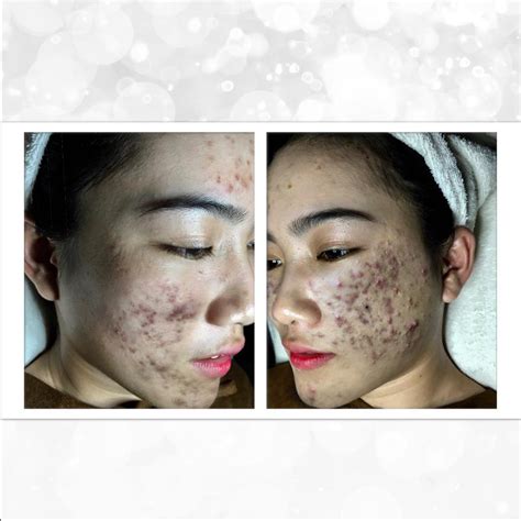 L T X C Th Nh Hot Streamer Sau N M Kh S V M N