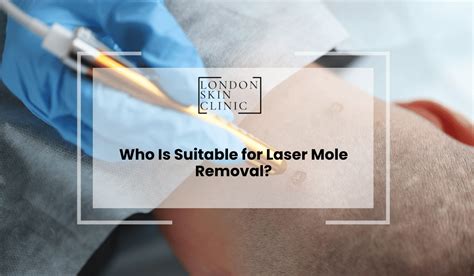 Mole Removal Aftercare Foods That Speed Up Healing London Skin Clinic