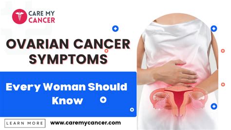 Spotting Early Signs Ovarian Cancer Symptoms Every Woman Should Know