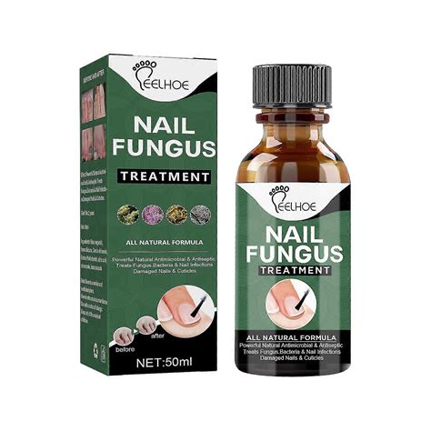 Buy 50ml Nail Fungus Treatment, Toenail Fungus Treatment, Extra