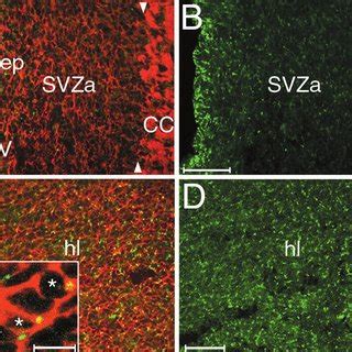 Discrete perinuclear localization of p19 I N K4d expression by cortical ...