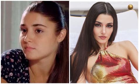 3 самые красивые турецкие актрисы и их изменения - пластика и уколы или ...