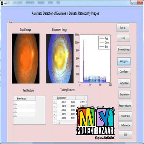 Automatic Detection of Exudates in Diabetic Retinopathy Images