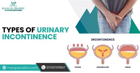 Types of Urinary Incontinence