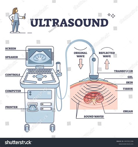 Ultrasound Patient Analysis Process Equipment Explanation Vector C