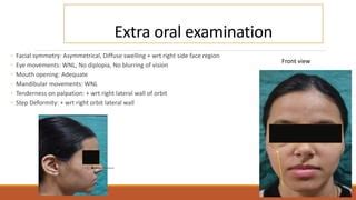 CLINICAL CASE PRESENTATION lateral wall orbit.pptx