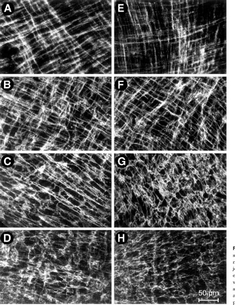 Figure From Development Of Interstitial Cells Of Cajal And Pacemaking