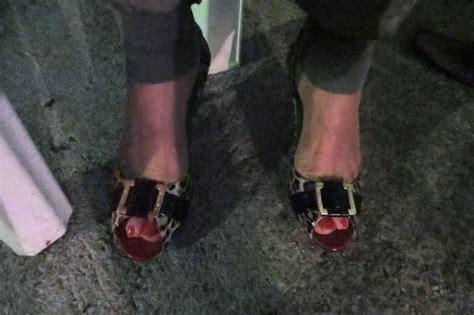 My Wifes Feet Are So Dried Out They Need Humidity Nude Pics Xhamster