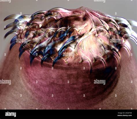 Tapeworm Head Light Micrograph Adult Tapeworms Tinea Sp Are