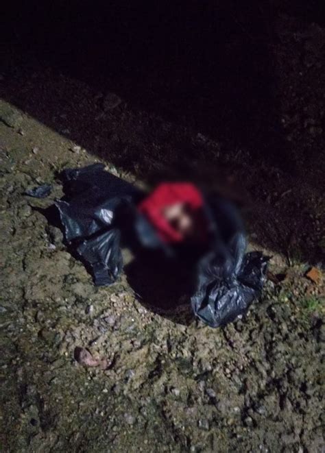 Imagens Fortes Cabe A Humana Encontrada Em Saco De Lixo Na Compensa