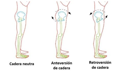 58 Síndrome Cruzado Inferior SCI