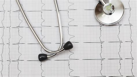 Пульс 110 ударов в минуту: что делать, если пульс в состоянии покоя 110 ...