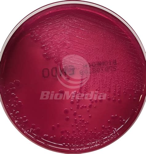 Агар Эндо (Endo Agar) - готовая питательная среда от Biomedia