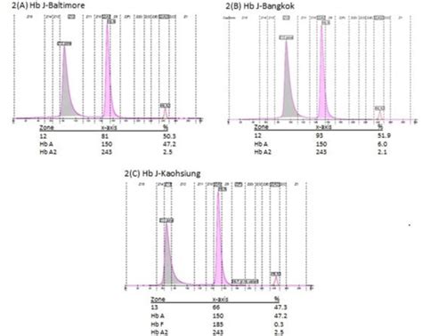 figure   chromatogram characteristics   hb