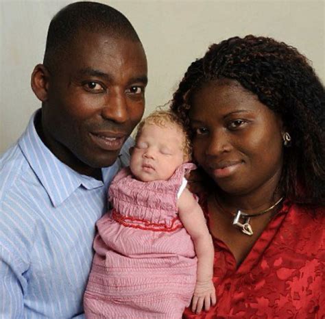 A Nigerian Couple Gave Birth To A Blonde Haired Blue Eyes White Baby Later Called The Miracle