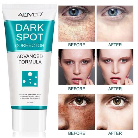dark spot face corrector 4