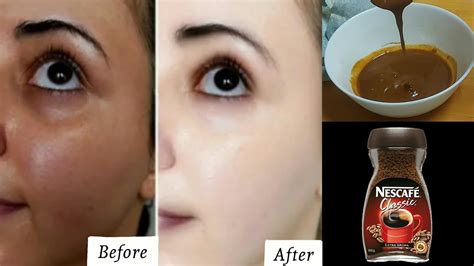 Face Whitening Home Remedy Coffee Face Pack For Acne Pimple Dark