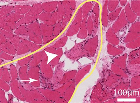 Shoulder Muscle Architecture, Physiology, and Plasticity ...