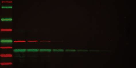 Immun Blot® Lf Low Fluorescence Pvdf Membranes Bioradiations