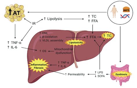 Pathophysiology Of Non Alcoholic Fatty Liver Disease 9 12 At Download Scientific Diagram