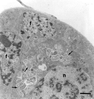 Inherited Microorganisms Sex Specific Virulence And Reproductive Parasitism Trends In Parasitology