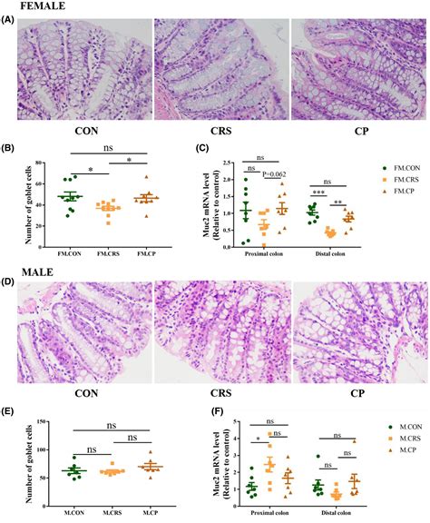 Sex Difference In Prebiotics On Gut And Bloodbrain Barrier Dysfunction Underlying Stress