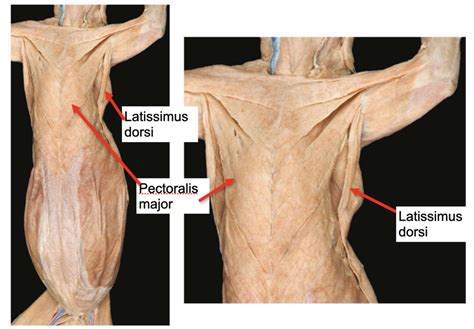 Musculature Of Cat Diagram Quizlet