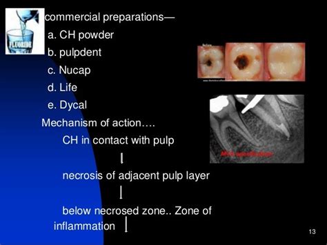 Pediatric Endodontics