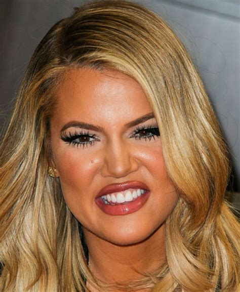 Khloe Kardashian Face Facial Fillers Gone Wrong