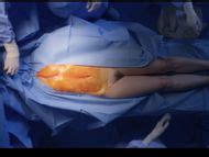 Anne Dorval Nue Photos Et Vid Os De Anne Dorval Nue Sex Tapes