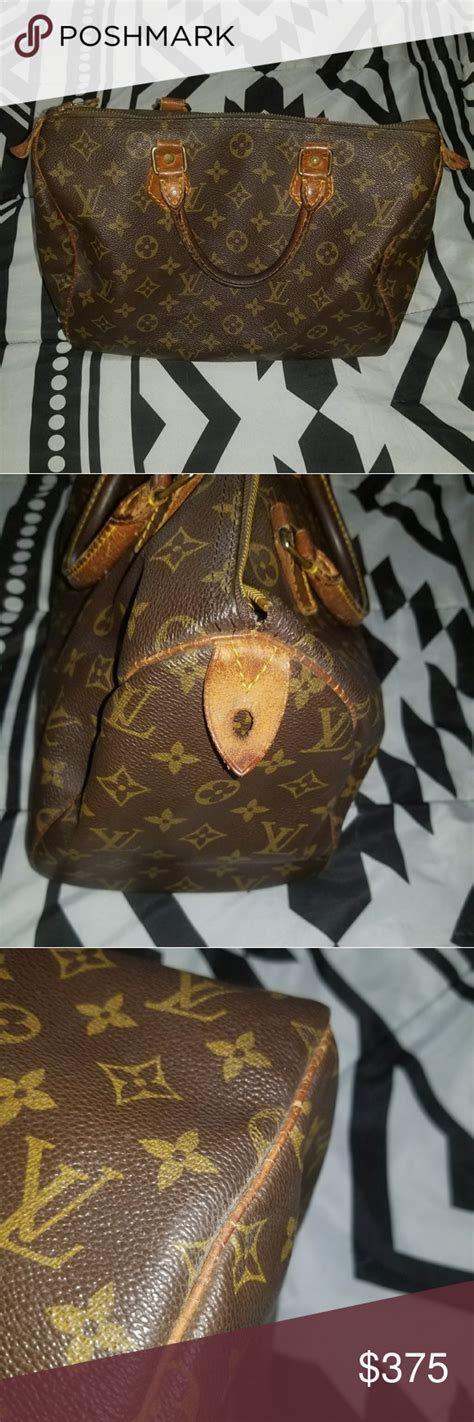 Louis Vuitton Speedy 30 Zipper Pull Replacement Literacy Basics