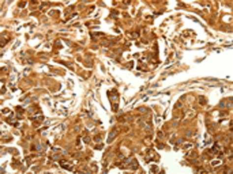 Map Lc A Anti Map Lc A Rabbit Polyclonal Antibody