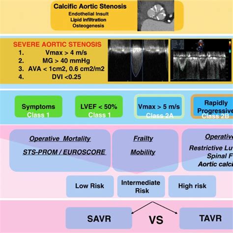 Suggested Algorithm For The Diagnosis And Management Of Aortic Stenosis