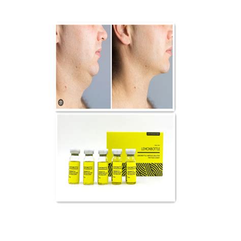 Fat Dissolving Lemonbottle Injection For Double Chin Face And Body